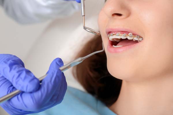 Kids Orthodontist: What Is Phase One?