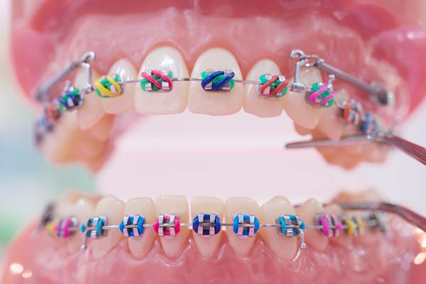 Orthodontist Near Me: Your Path To A Confident Smile