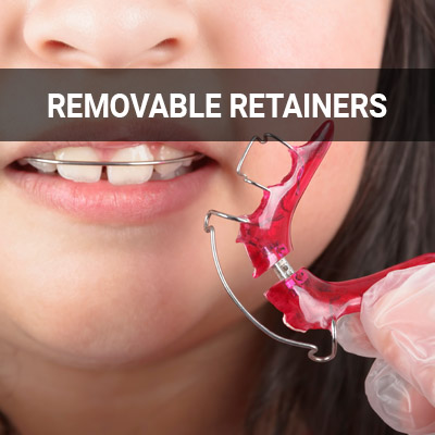 Navigation image for our Removable Retainers page